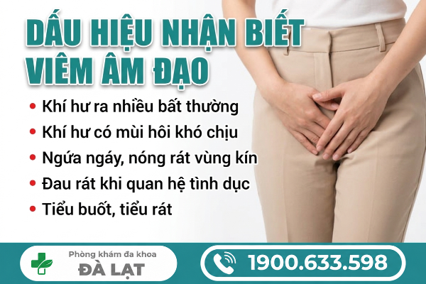 Hình ảnh minh họa
